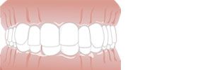 Zahn- und Kieferfehlstellungen